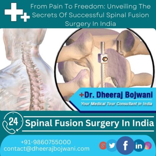 From Pain To Freedom Unveiling The Secrets Of Successful Spinal Fusion Surgery In India
